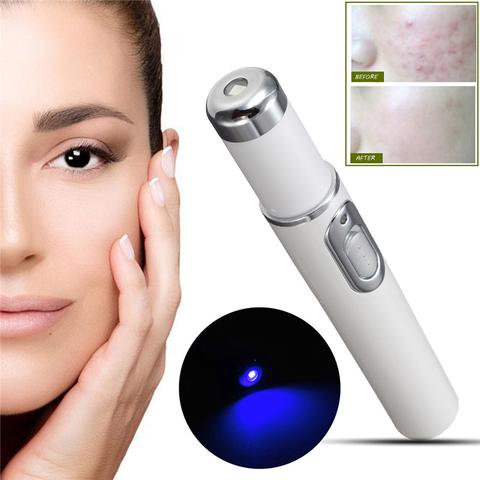 Supporty™ Acne Laser